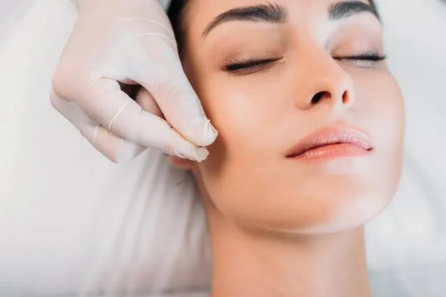 Facial rejuvenation acupuncture